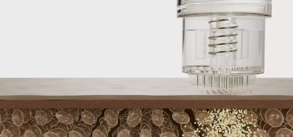 Cosmetic packaging design microneedle infusion device penetrating skin layer diagram